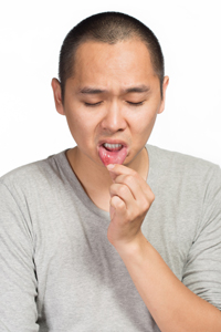 Man with Canker Sore on Lip
